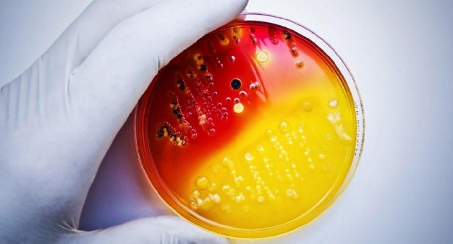 CAMS case study 4