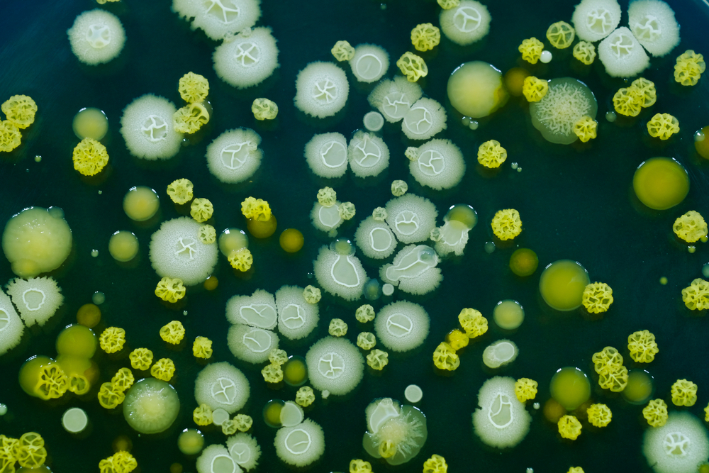 Microbial growth and colonies